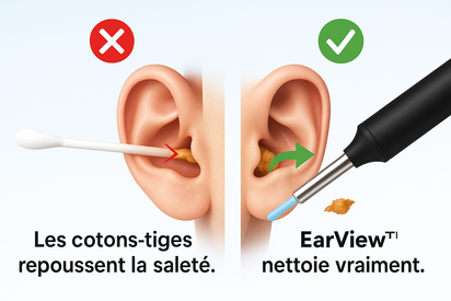 EarView™ - L’alternative sûre et moderne aux cotons-tiges