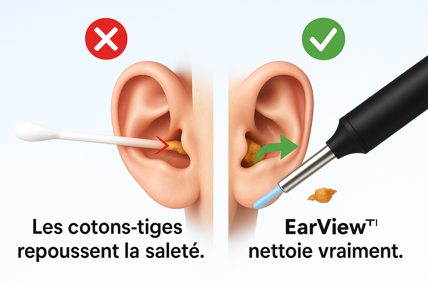 EarView™ - L’alternative sûre et moderne aux cotons-tiges