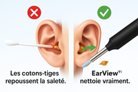 EarView™ - L’alternative sûre et moderne aux cotons-tiges